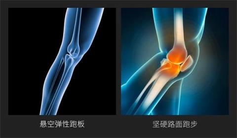 小米眾籌首款智能折疊跑步機來襲，讓愛跑步的人有“地”放矢